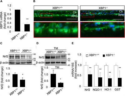 Regulation of Nrf2 by X Box-Binding Protein 1 in Retinal Pigment Epithelium